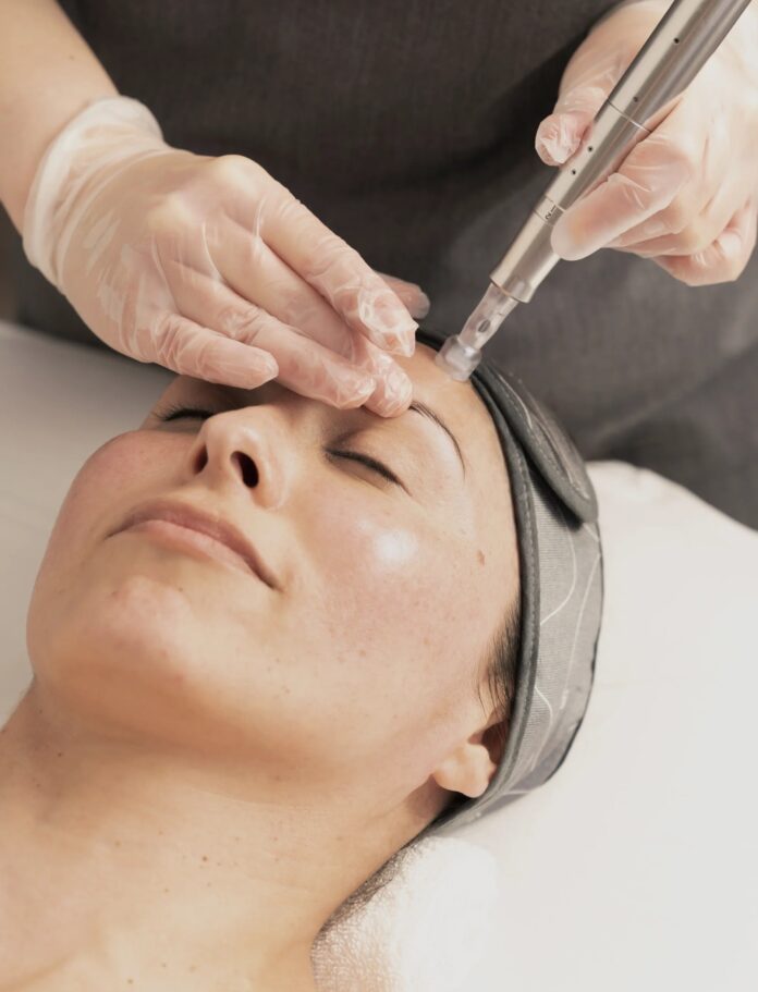 mezoterapia